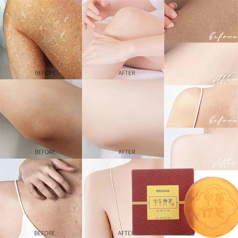 Body Whitening Soap – Deep Cleansing & Skin Brightening