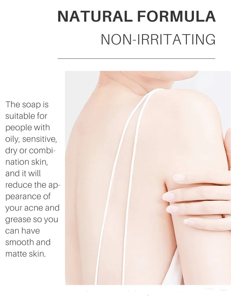 Body Whitening Soap – Deep Cleansing & Skin Brightening