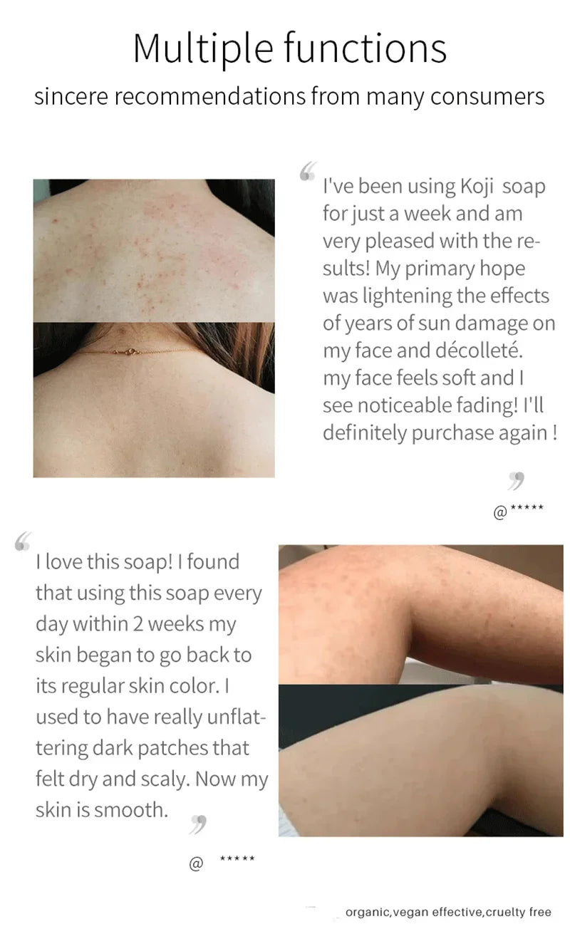 Body Whitening Soap – Deep Cleansing & Skin Brightening