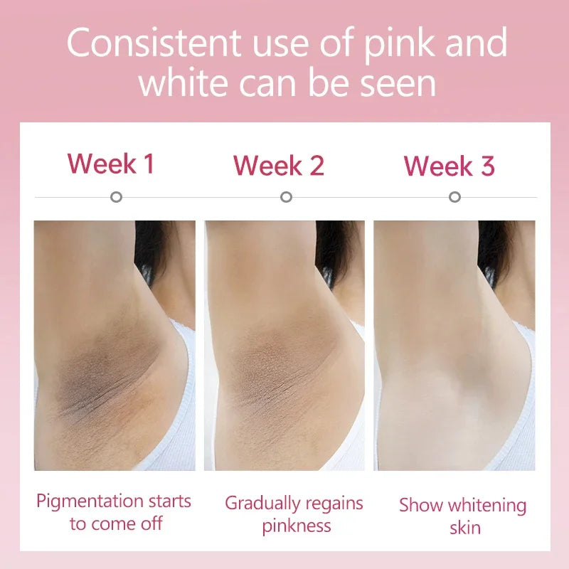 Whitening Cream for Dark Skin – Brightening & Nourishing Body Care