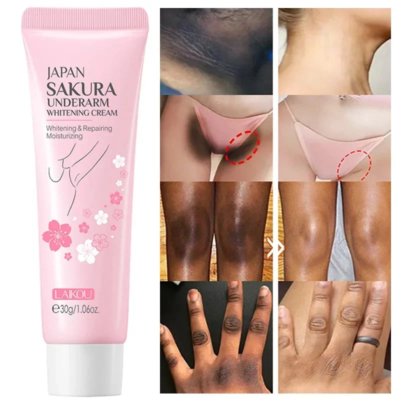 Whitening Cream for Dark Skin – Brightening & Nourishing Body Care