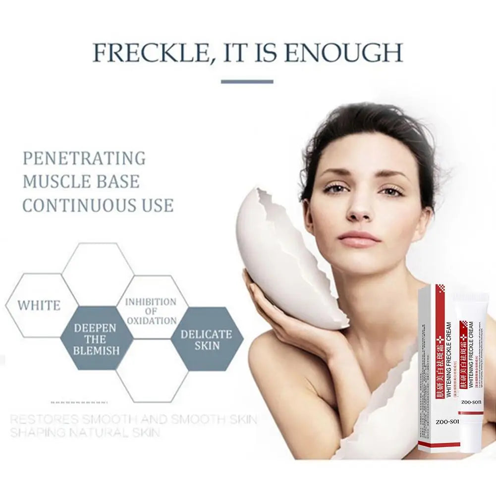 Whitening Freckle Cream – Dark Spot & Pigmentation Remover (20g)