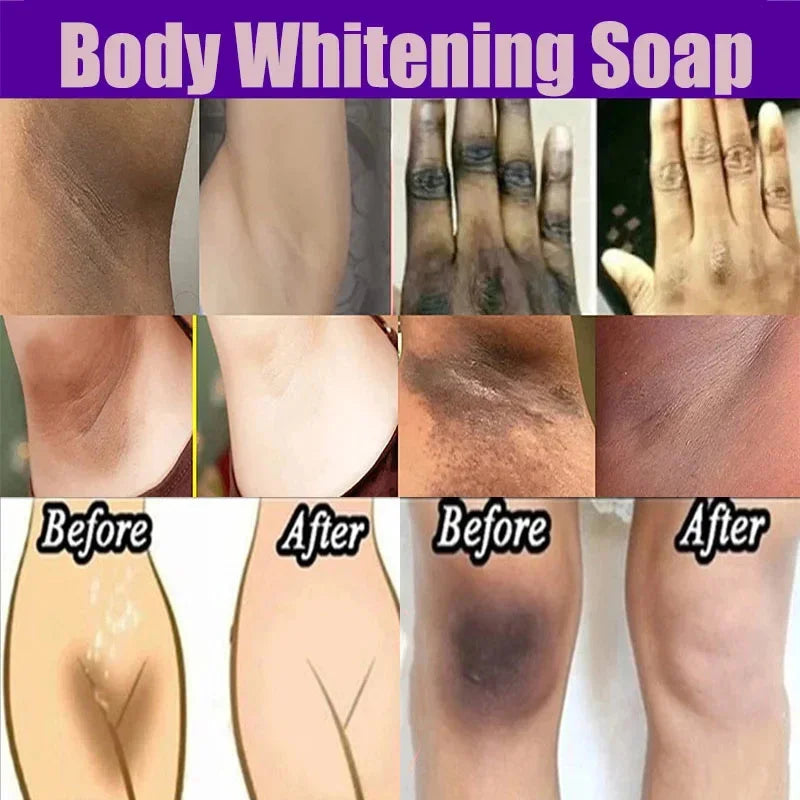 Body Whitening Soap – Deep Cleansing & Skin Brightening