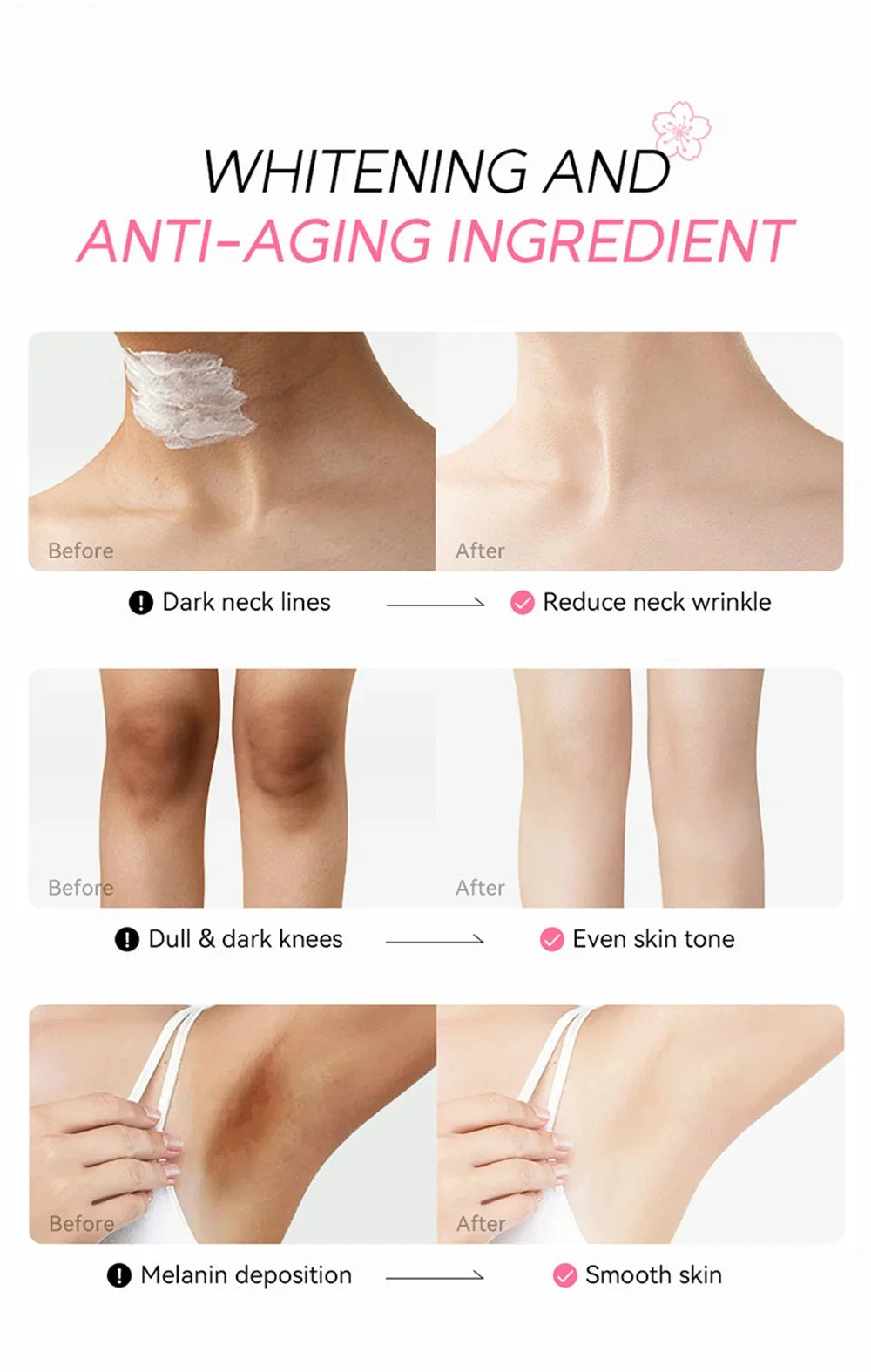 Whitening Cream for Dark Skin – Brightening & Nourishing Body Care
