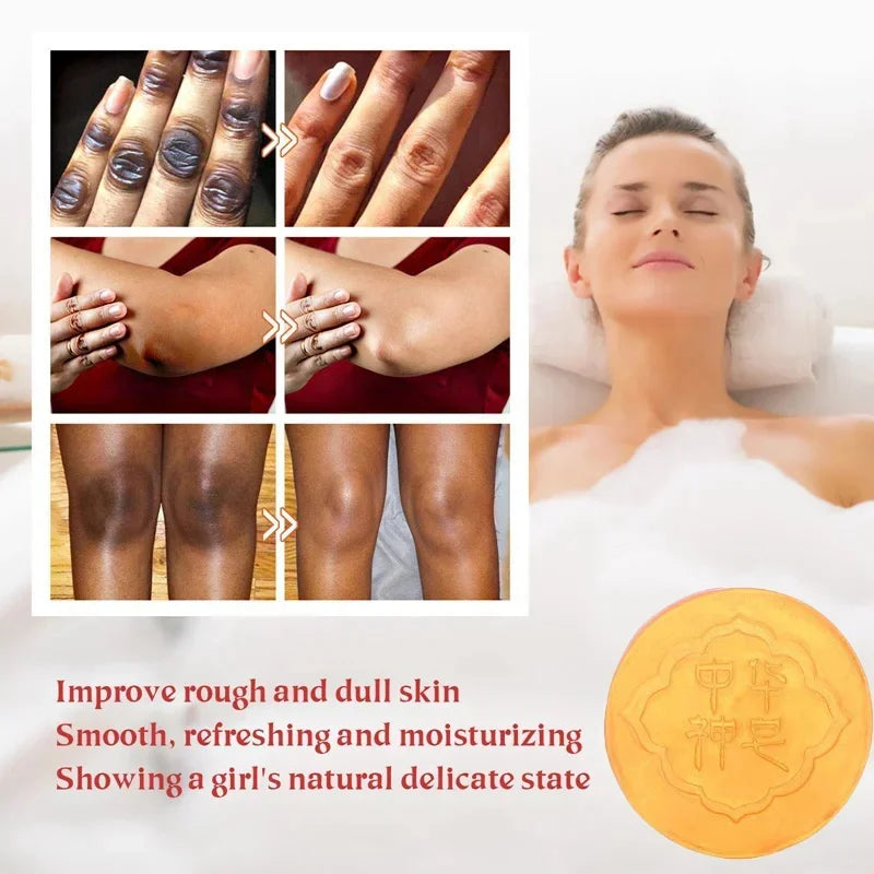 Body Whitening Soap – Deep Cleansing & Skin Brightening